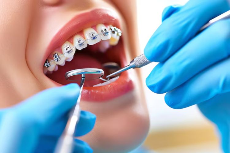 Orthodontics Treatment in Guntur