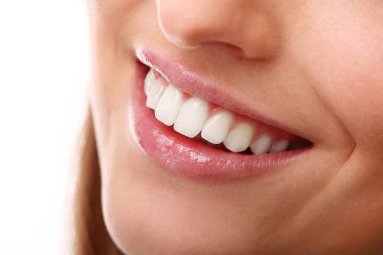 Teeth Whitening in Guntur